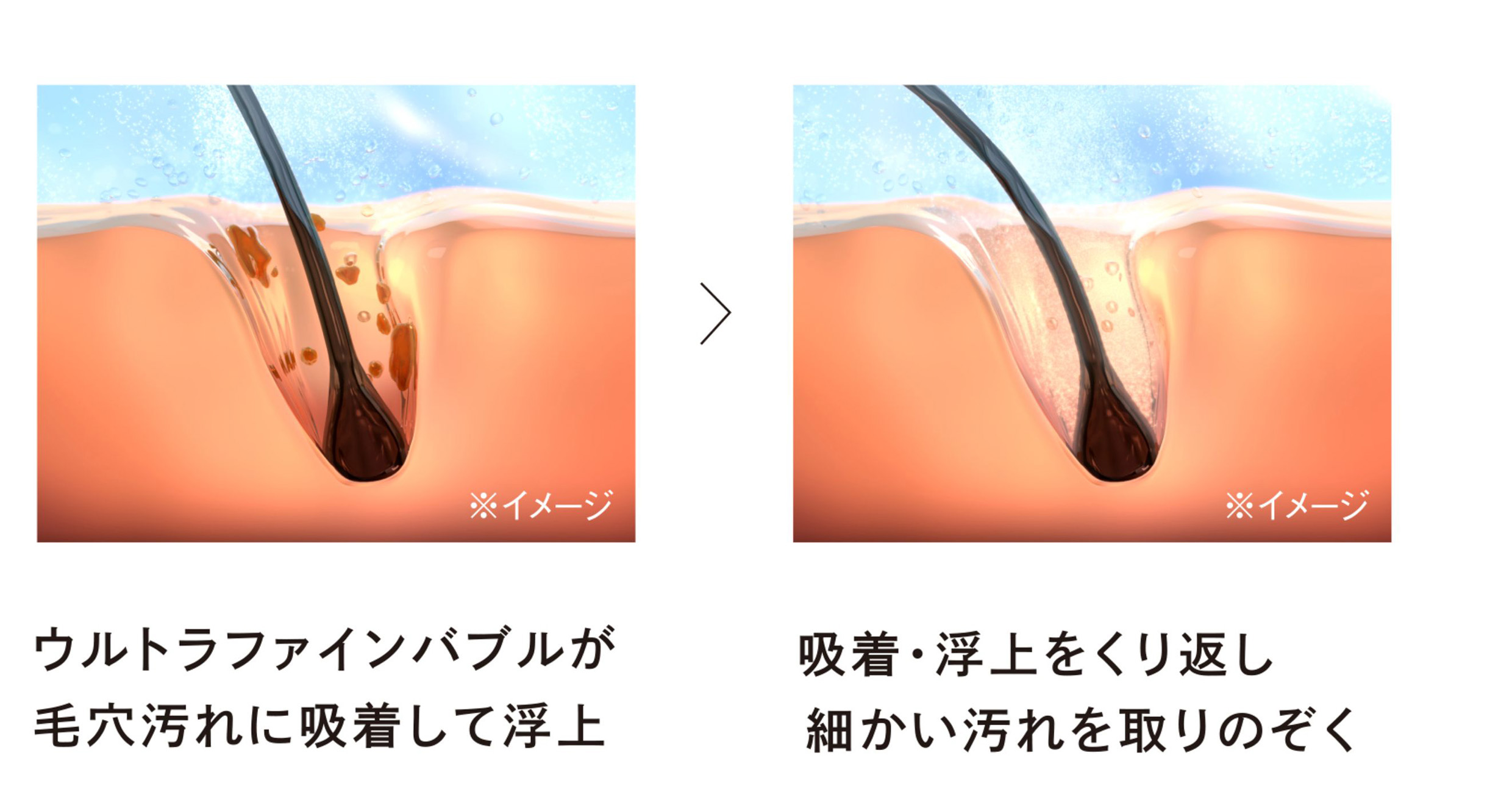 毛穴汚れイメージ